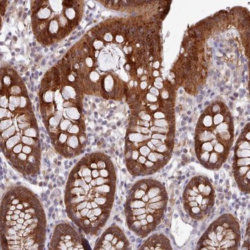 Anti-CES3 antibody produced in rabbit Prestige Antibodies&#174; Powered by Atlas Antibodies, affinity isolated antibody, buffered aqueous glycerol solution