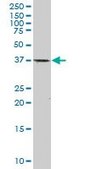 Monoclonal Anti-CDX2 antibody produced in mouse clone 1C7, purified immunoglobulin, buffered aqueous solution