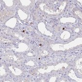 Anti-TMEM251 antibody produced in rabbit Prestige Antibodies® Powered by Atlas Antibodies, affinity isolated antibody, buffered aqueous glycerol solution