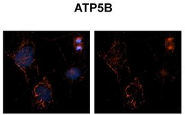 Anti-ATP5B (AB2) antibody produced in rabbit IgG fraction of antiserum