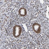 Anti-ILKAP antibody produced in rabbit Prestige Antibodies® Powered by Atlas Antibodies, affinity isolated antibody, buffered aqueous glycerol solution