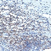 Anti-CHD3 antibody produced in rabbit