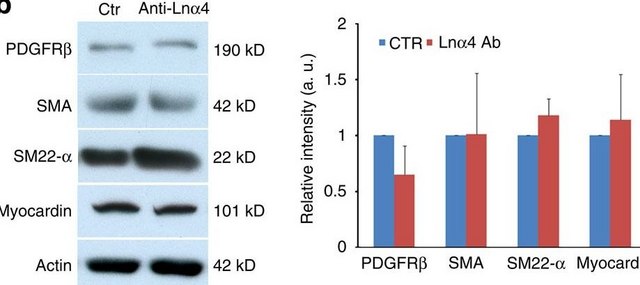 抗-肌动蛋白，&#945;-平滑肌- FITC抗体，小鼠单克隆 小鼠抗 clone 1A4, purified from hybridoma cell culture