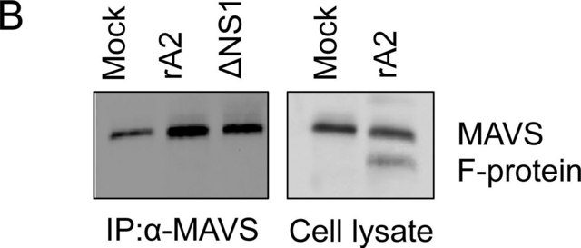 抗-RSV抗体，融合蛋白，所有A、B型毒株，克隆133-1H clone 133-1H, Chemicon&#174;, from mouse