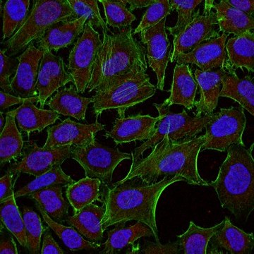 Anti-Dynein Antibody, IC, cytosolic, clone 74.1, Alexa Fluor&#8482; 555 conjugate clone 74.1, from mouse, ALEXA FLUOR&#8482; 555