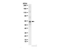 Anti-Dyskerin (Sheep) from sheep, purified by affinity chromatography