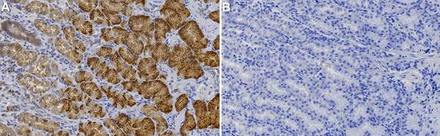 Anti-&#948; Tubulin Antibody, clone 1B20 ZooMAb&#174; Rabbit Monoclonal recombinant, expressed in HEK 293 cells