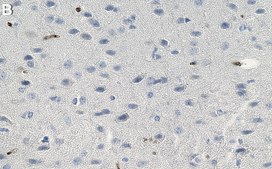 Anti-Reelin Antibody, clone 142 ZooMAb&#174; Mouse Monoclonal recombinant, expressed in HEK 293 cells