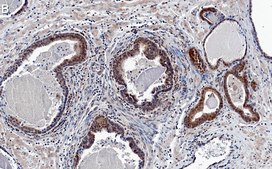 Anti-AKT1 Antibody, clone 4K6 ZooMAb® Rabbit Monoclonal recombinant, expressed in HEK 293 cells