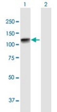 Anti-ADD2 antibody produced in mouse purified immunoglobulin, buffered aqueous solution