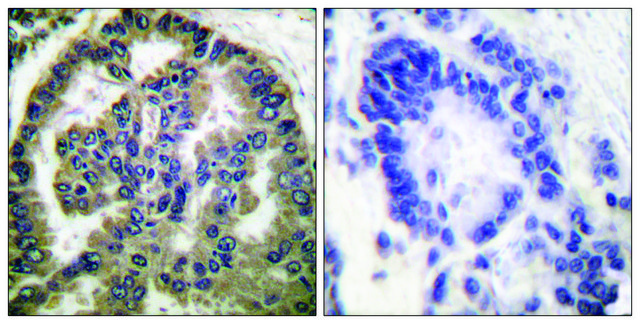 Anti-TGF &#946;2, C-Terminal antibody produced in rabbit affinity isolated antibody