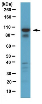 Anti-Rab11-FIP1/RCP Antibody from rabbit, purified by affinity chromatography