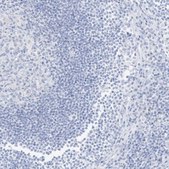 Anti-SLC22A13 antibody produced in rabbit Prestige Antibodies® Powered by Atlas Antibodies, affinity isolated antibody, buffered aqueous glycerol solution