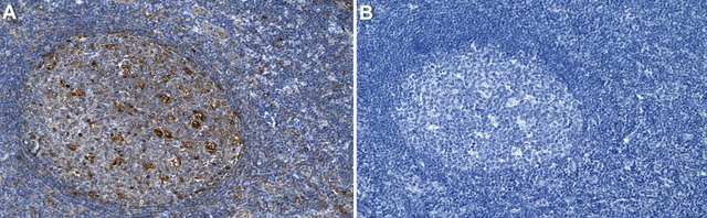 Anti-IL-13 Antibody, clone 1B10 ZooMAb&#174; Rabbit Monoclonal recombinant, expressed in HEK 293 cells