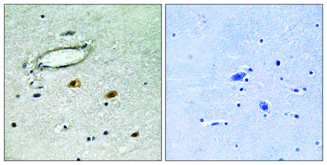 Anti-HSP27 antibody produced in rabbit affinity isolated antibody