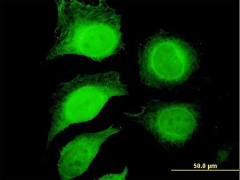 Anti-GAPDH antibody produced in mouse purified immunoglobulin, buffered aqueous solution