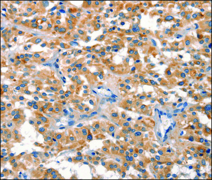 Anti-DUSP2 antibody produced in rabbit affinity isolated antibody