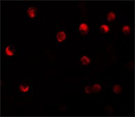 Anti-NALP11 antibody produced in rabbit affinity isolated antibody, buffered aqueous solution