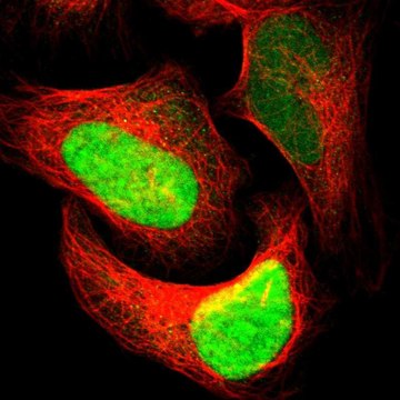 Anti-APEX1 antibody produced in rabbit Prestige Antibodies&#174; Powered by Atlas Antibodies, affinity isolated antibody