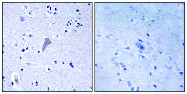 Anti-MTOR antibody produced in rabbit affinity isolated antibody