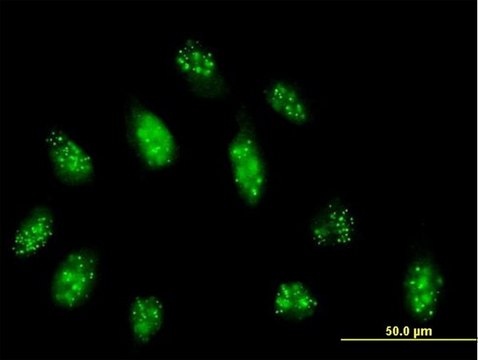 Anti-CENPB antibody produced in mouse purified immunoglobulin, buffered aqueous solution