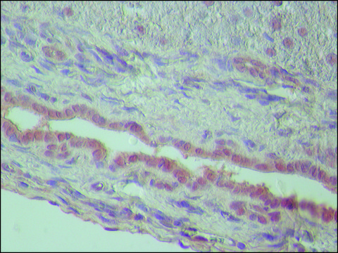 Anti-TDP-43 antibody produced in rabbit ~1.5&#160;mg/mL, affinity isolated antibody, buffered aqueous solution