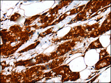 Anti-UBE2V1 affinity isolated antibody