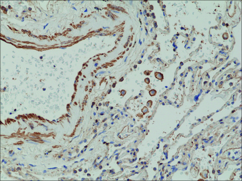 Anti-Matrix metalloproteinase-12 (MMP-12) antibody, Rabbit monoclonal recombinant, expressed in HEK 293 cells, clone RM381, purified immunoglobulin