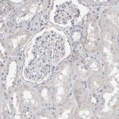 Anti-SERPINB7 antibody produced in rabbit Prestige Antibodies® Powered by Atlas Antibodies, affinity isolated antibody, buffered aqueous glycerol solution