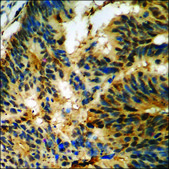 Anti-phospho-Merlin (pSer10) antibody produced in rabbit affinity isolated antibody