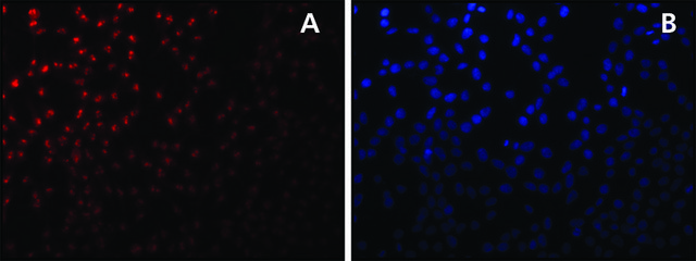 Anti-Sirt7 antibody produced in rabbit affinity isolated antibody, buffered aqueous solution