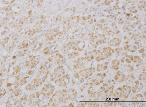 Monoclonal Anti-DKFZp761P0423 antibody produced in mouse clone 5C6, purified immunoglobulin, buffered aqueous solution