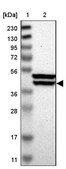 Anti-KLHDC8B antibody produced in rabbit Prestige Antibodies® Powered by Atlas Antibodies, affinity isolated antibody, buffered aqueous glycerol solution