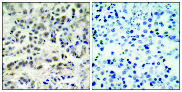 Anti-p27 KIP1 antibody produced in rabbit affinity isolated antibody