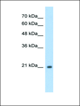 Anti-TSHR antibody produced in rabbit IgG fraction of antiserum