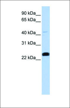 Anti-LYCAT affinity isolated antibody