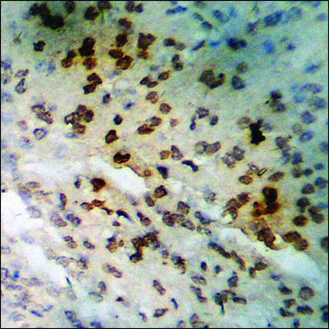 Anti-phospho-BTK (pTyr223) antibody produced in rabbit affinity isolated antibody