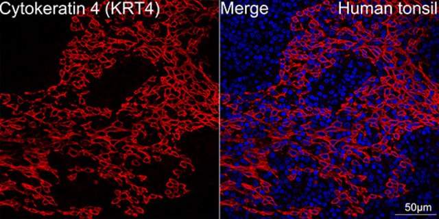 Anti-Cytokeratin 4 (KRT4) Antibody, clone 6H9R6, Rabbit Monoclonal