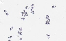 Anti-Cytomegalovirus Antibody, clone 8B1.2 ZooMAb® Mouse Monoclonal recombinant, expressed in HEK 293 cells