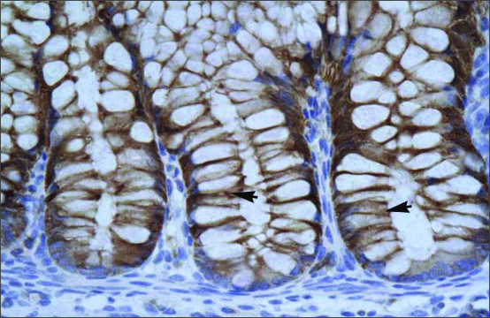 Anti-SUV39H1 antibody produced in rabbit IgG fraction of antiserum