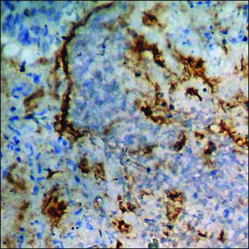 Anti-phospho-Calcium Sensing Receptor (pThr888) antibody produced in rabbit affinity isolated antibody