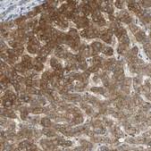 Anti-IL17RB antibody produced in rabbit Prestige Antibodies® Powered by Atlas Antibodies, affinity isolated antibody, buffered aqueous glycerol solution