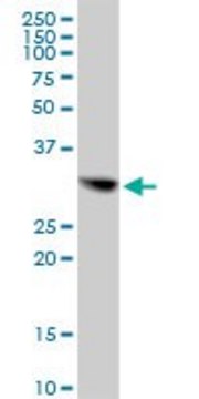 Anti-CBR1 antibody produced in mouse purified immunoglobulin, buffered aqueous solution