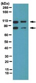 Anti-Amphiphysin II Antibody from rabbit, purified by affinity chromatography