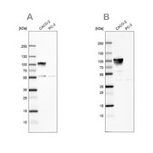 Anti-VIL1 antibody produced in rabbit Ab2, Prestige Antibodies® Powered by Atlas Antibodies, affinity isolated antibody, buffered aqueous glycerol solution