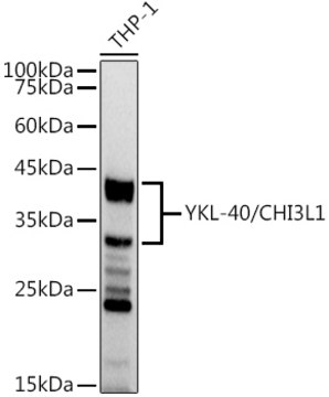 Anti-YKL-40/CHI3L1 Antibody, clone 7T1R3, Rabbit Monoclonal