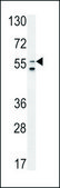 ANTI-SLC5A12 (C-TERM) antibody produced in rabbit IgG fraction of antiserum, buffered aqueous solution