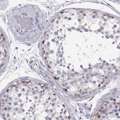 Anti-MAGEC1 antibody produced in rabbit Prestige Antibodies® Powered by Atlas Antibodies, affinity isolated antibody, buffered aqueous glycerol solution