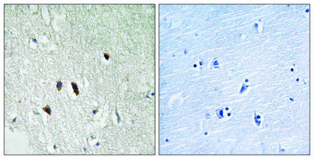 Anti-RIPK2 antibody produced in rabbit affinity isolated antibody