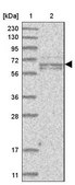 Anti-GALNTL6 antibody produced in rabbit Prestige Antibodies® Powered by Atlas Antibodies, affinity isolated antibody, buffered aqueous glycerol solution